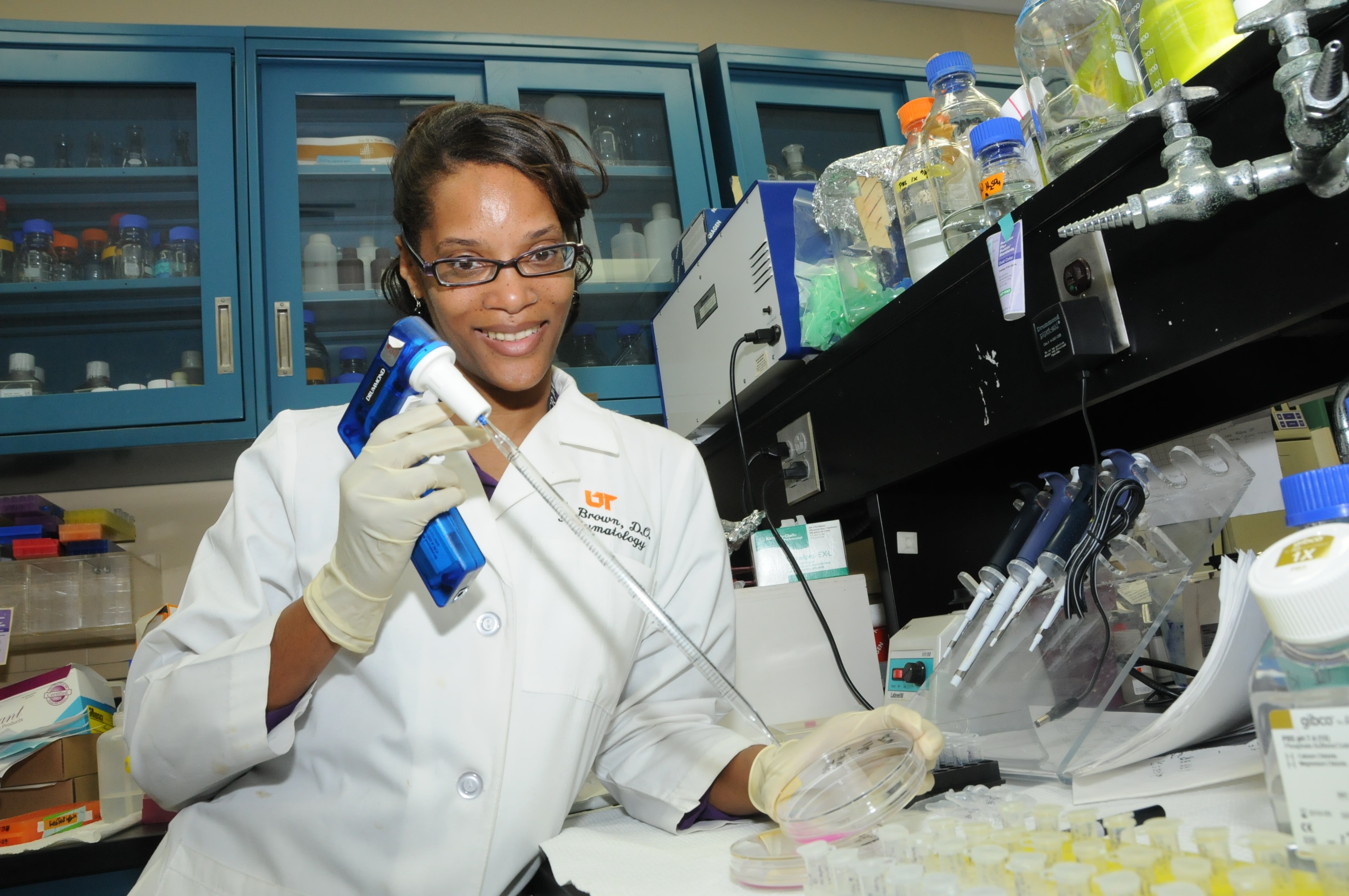 A $150,000 grant from the Scleroderma Foundation will allow Dr. Monica Brown and her research team to explore treatment options for the disease. They are using a natural form of vitamin D in their trials.